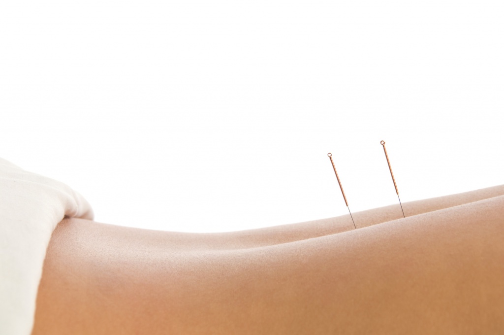 acupuncture osteohondroz -foto